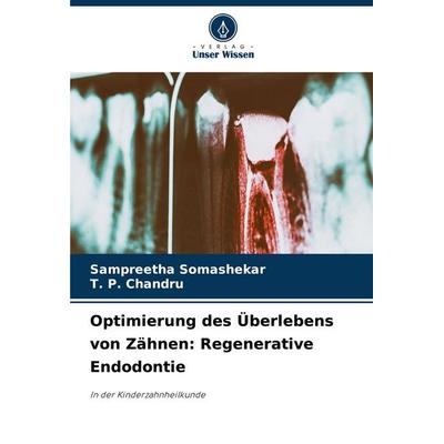 Optimierung des Überlebens von Zähnen: Regenerative Endodontie, Taschenbuch von Sampreetha Somashekar,T. P. Chandru, Verlag Unser Wissen,