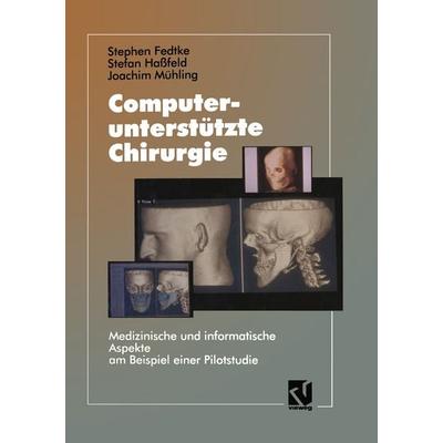Computerunterstützte Chirurgie, Taschenbuch von Stephen Fedtke, Vieweg & Teubner, 978-3-663-05238-8