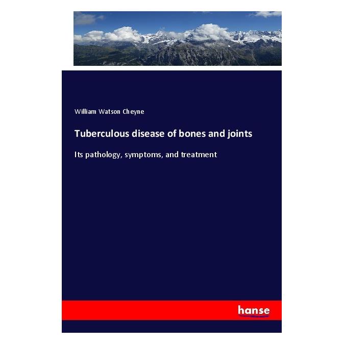 Hansebooks Tuberculous disease of bones and joints (Englisch, Softcover, William Watson Cheyne) (55986395)
