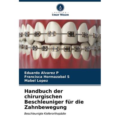 Handbuch der chirurgischen Beschleuniger für die Zahnbewegung, Taschenbuch von Eduardo Alvarez P.,Francisca Hormazabal S.,Mabel Lopez, Verlag Unser
