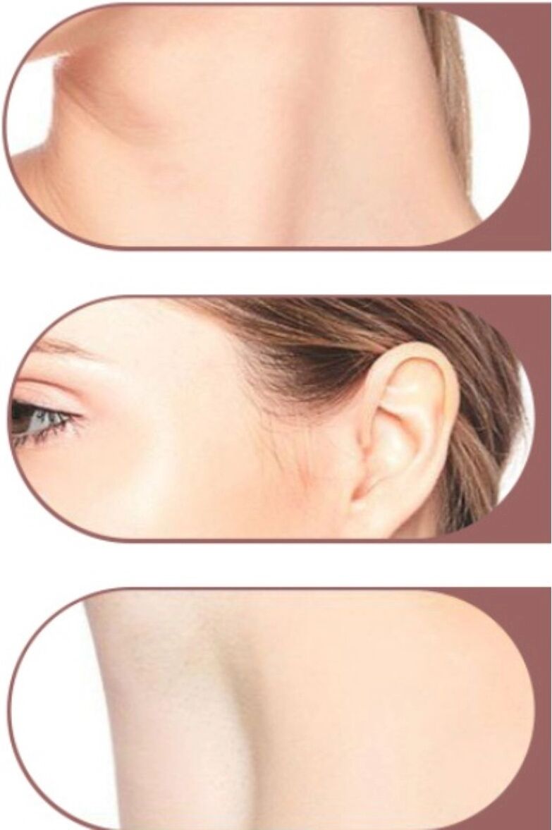 INF IPL-Ganzkörper-Haarentfernungsgerät für zu Hause mit EU-Stecker für Gesicht, Achseln, Beine, Bikinizone und Rücken Rosa