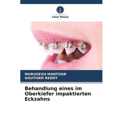 Behandlung eines im Oberkiefer impaktierten Eckzahns, Taschenbuch von Murugesh Mantoor,Goutham REDDY, Verlag Unser Wissen