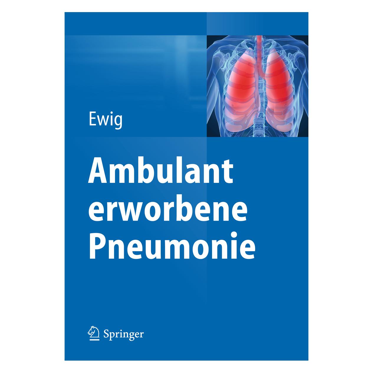 Springer Ambulant erworbene Pneumonie (Deutsch, Hardcover, Santiago Ewig) (9783662473115)