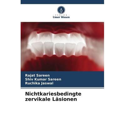Nichtkariesbedingte zervikale Läsionen, Taschenbuch von Rajat Sareen,Shiv Kumar Sareen,Ruchika Jaswal, Verlag Unser Wissen