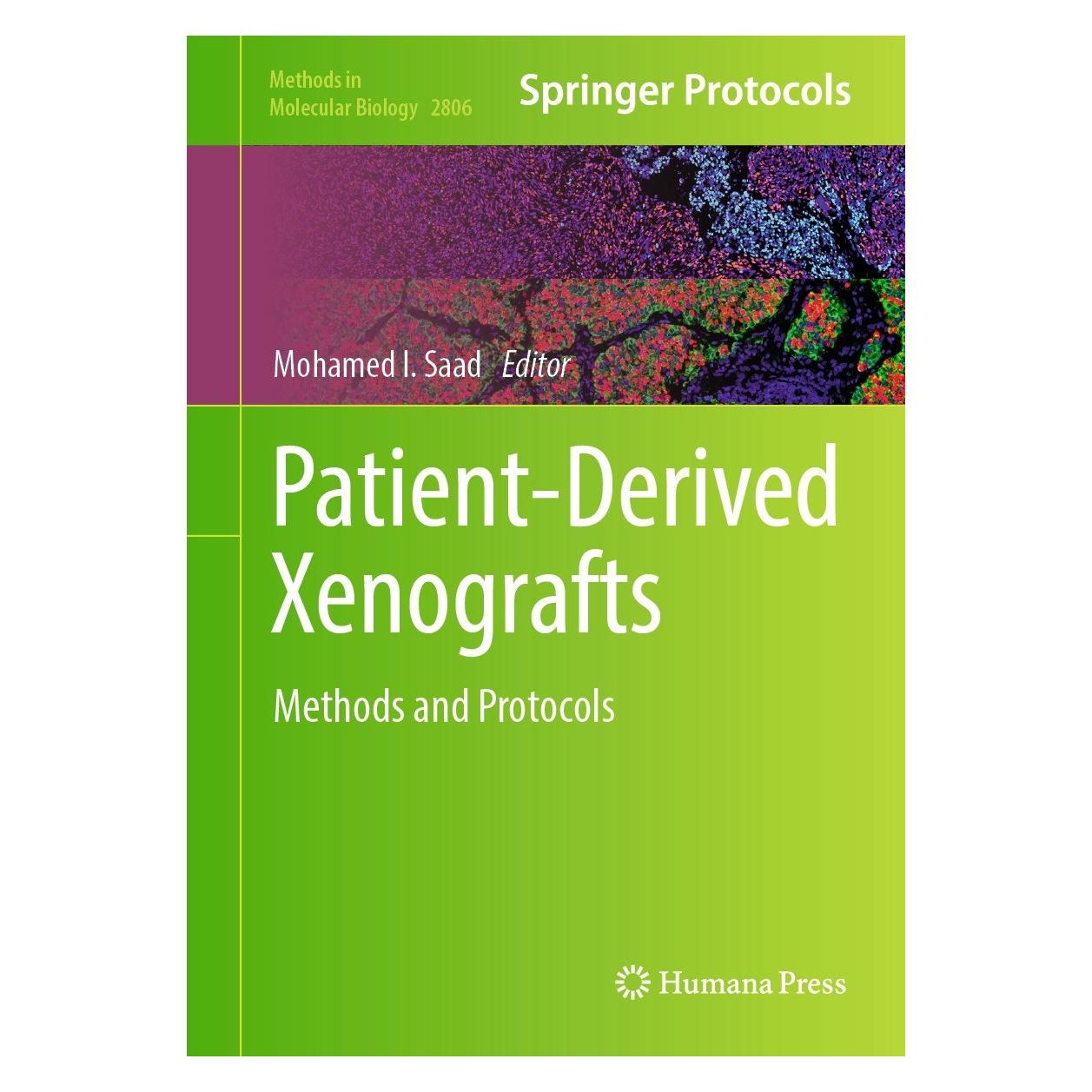 Springer Patient-Derived Xenografts (Englisch, Hardcover, Mohamed I. Saad) (9781071638576)