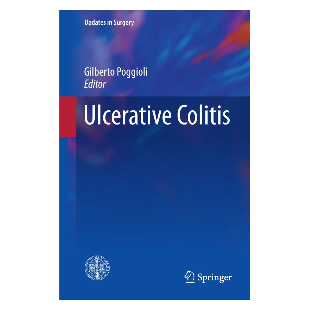 Springer Ulcerative Colitis (Englisch, Softcover) (55982434)