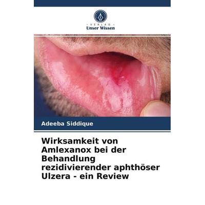 Wirksamkeit von Amlexanox bei der Behandlung rezidivierender aphthöser Ulzera - ein Review, Taschenbuch von Adeeba siddique, Verlag Unser Wissen,