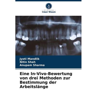 Eine In-Vivo-Bewertung von drei Methoden zur Bestimmung der Arbeitslänge, Taschenbuch von Jyoti Mandlik,Nitin Shah,Anupam Sharma, Verlag Unser Wissen,