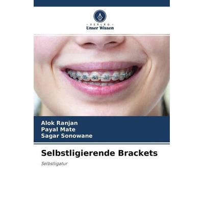 Selbstligierende Brackets, Taschenbuch von Alok Ranjan,Payal mate,Sagar Sonowane, Verlag Unser Wissen, 978-620-4-65160-6