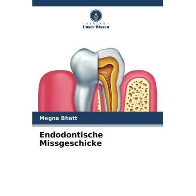 Endodontische Missgeschicke, Taschenbuch von Megna Bhatt, Verlag Unser Wissen, 978-620-5-61297-2