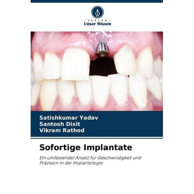 Sofortige Implantate, Taschenbuch von Satishkumar Yadav,Santosh Dixit,Vikram Rathod, Verlag Unser Wissen, 978-620-8-06045-9