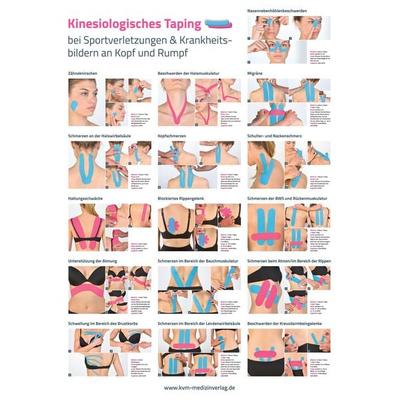 Poster Kinesiologisches Taping (3 Poster im Set), Set von Roland Kreutzer, KVM - Der Medizinverlag, 978-3-86867-749-2