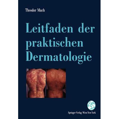 Leitfaden der praktischen Dermatologie, Taschenbuch von Theodor Much, Springer Wien, 978-3-211-82555-6
