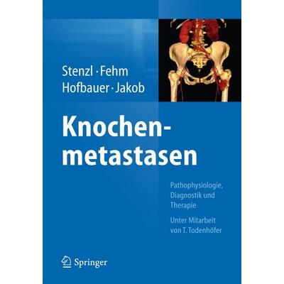 Knochenmetastasen, Gebundene Ausgabe von , Springer Berlin, 978-3-662-43470-3