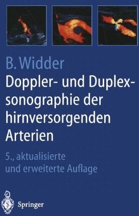 Bernhard Widder - Doppler- und Duplexsonographie der hirnversorgenden Arterien - Preis vom 11.10.2026 03:10:56 h