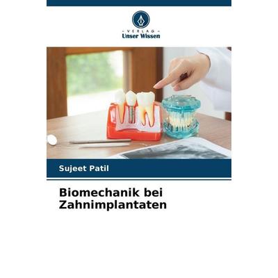 Biomechanik bei Zahnimplantaten, Taschenbuch von Sujeet Patil, Verlag Unser Wissen, 978-620-2-36734-9