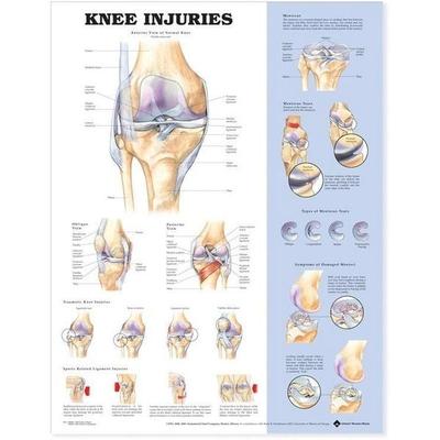 Knee Injuries Anatomical Chart, von , Wolters Kluwer Health, 978-1-58779-757-6