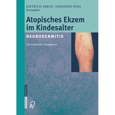 Atopisches Ekzem im Kindesalter (Neurodermitis), Taschenbuch von , Steinkopff, 978-3-642-63294-5