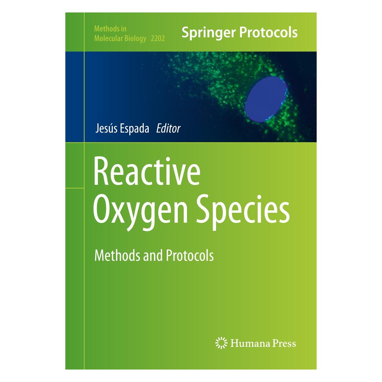 Springer Reactive Oxygen Species (Englisch, Jesús Espada, 2020) (9781071608951)