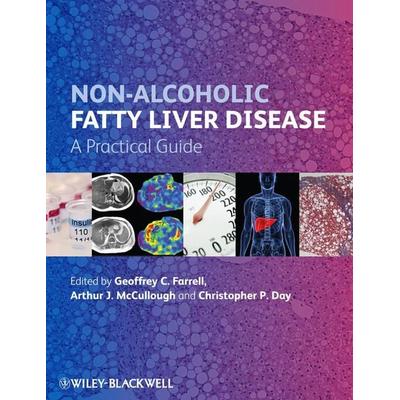 Non-Alcoholic Fatty Liver Disease, Gebundene Ausgabe von Geoffrey C. Mccullough, Arthur J. Day, Ch Farrell, John Wiley & Sons Inc, 978-0-470-67317-1