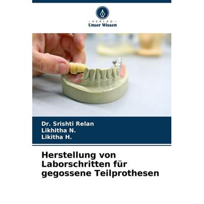 Herstellung von Laborschritten für gegossene Teilprothesen, Taschenbuch von Srishti Relan,Likhitha N.,Likitha H., Verlag Unser Wissen,