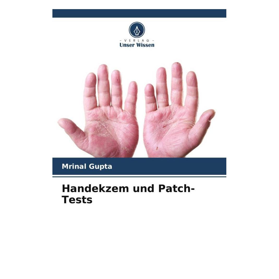 Unser Wissen Handekzem und Patch-Tests (56920648)