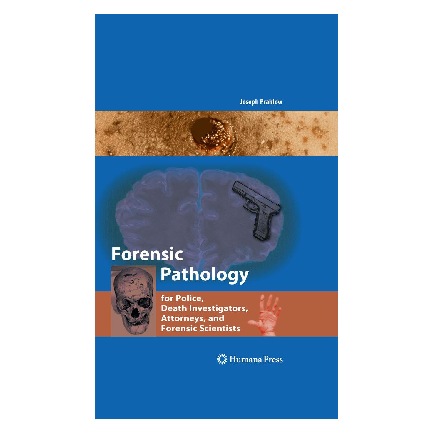 Springer Forensic Pathology for Police, Death Investigators, Attorneys, and Forensic Scientists (Englisch, Hardcover, Joseph A. Prahlow, Joseph Prahlow) (9781588299758)
