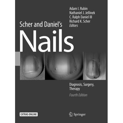 Scher and Daniel's Nails, Taschenbuch von , Springer, 978-3-030-09744-8