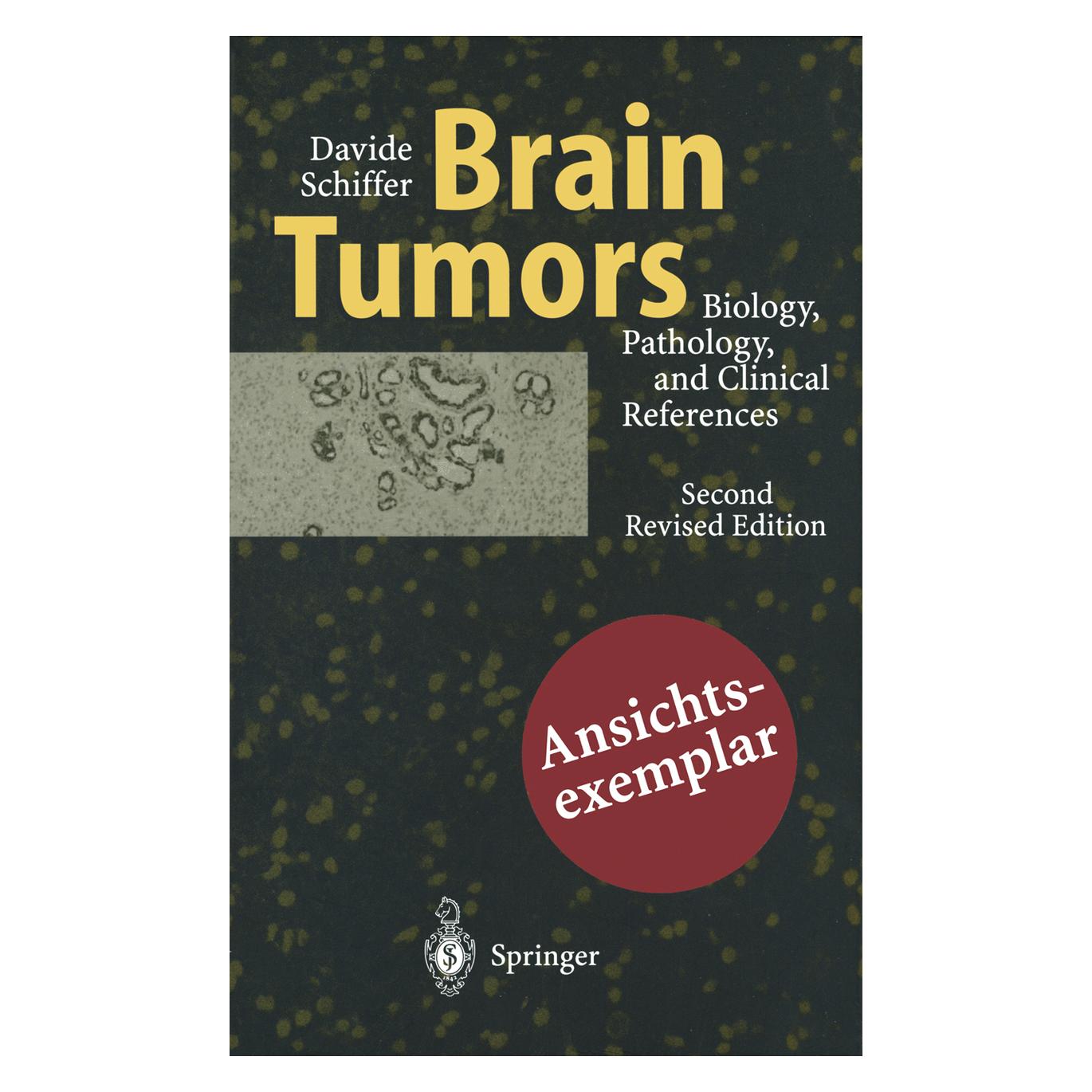 Springer Brain Tumors (Englisch, Softcover, Davide Schiffer) (55530531)