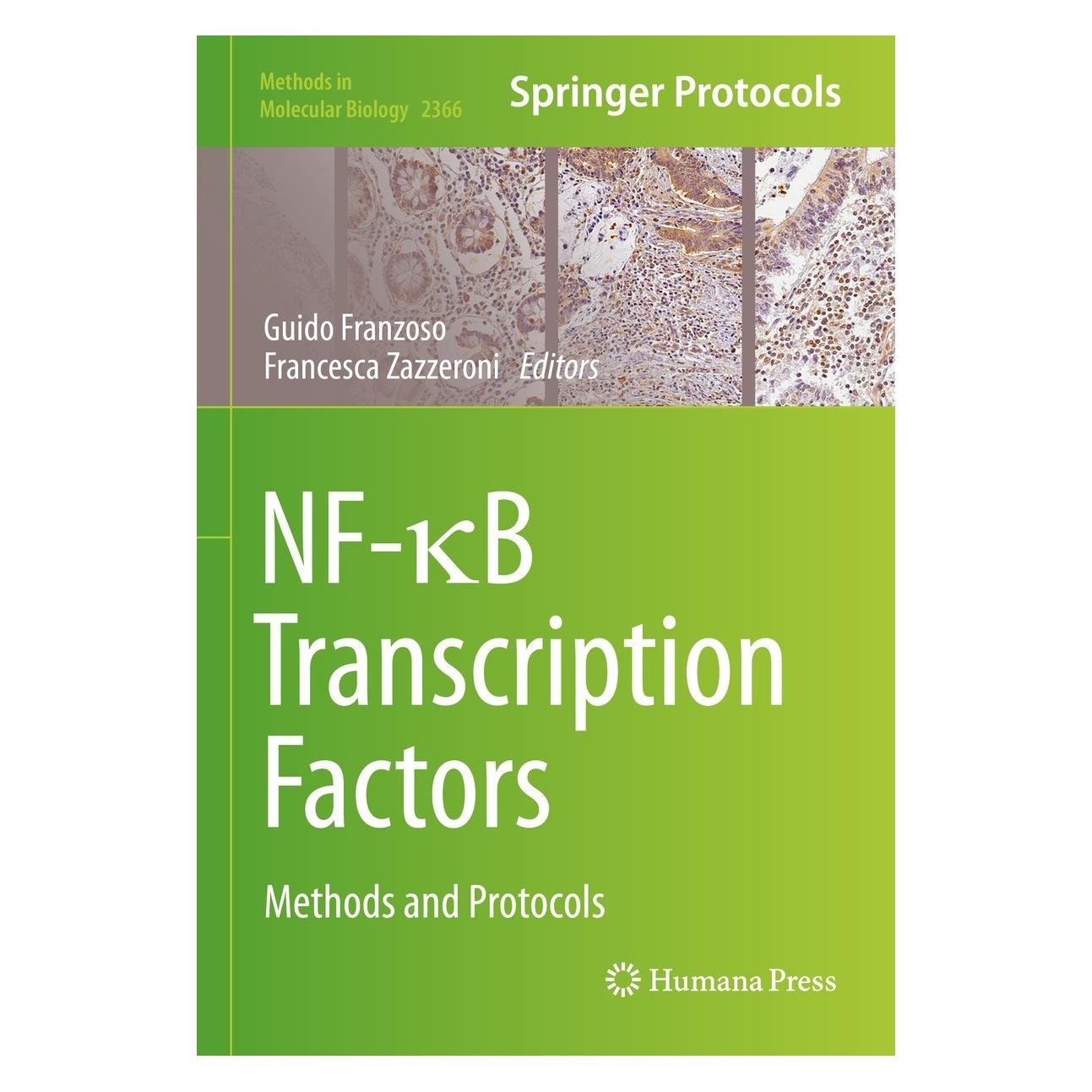 Springer NF-B Transcription Factors (Englisch, Hardcover, Francesca Zazzeroni, Guido Franzoso) (9781071616680)