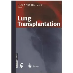 Lung Transplantation, Fachbücher