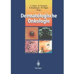Dermatologische Onkologie, Fachbücher von Claus Garbe, Roland Kaufmann, Reinhard Dummer, Wolfgang Tilgen