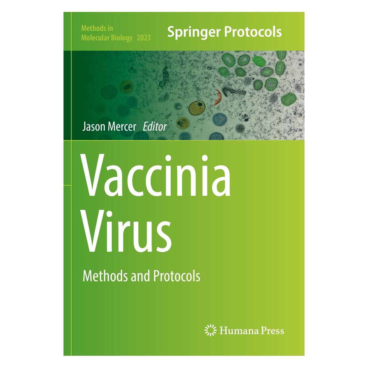 Springer Vaccinia Virus (Englisch, Softcover, Jason Mercer) (56156032)