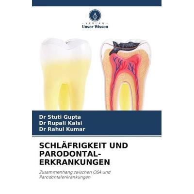 SCHLÄFRIGKEIT UND PARODONTAL- ERKRANKUNGEN, Taschenbuch von Stuti Gupta,Rupali Kalsi,Rahul Kumar, Verlag Unser Wissen, 978-620-6-13391-9