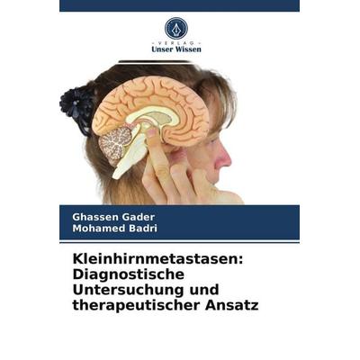 Kleinhirnmetastasen: Diagnostische Untersuchung und therapeutischer Ansatz, Taschenbuch von Ghassen Gader,Mohamed Badri, Verlag Unser Wissen,