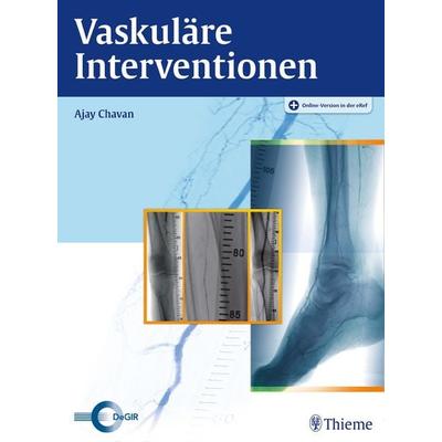 Vaskuläre Interventionen, Set von Ajay Chavan, Thieme, 978-3-13-153201-5