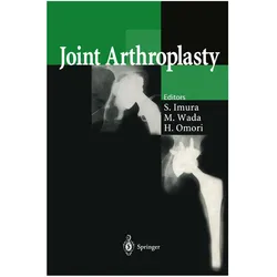 Joint Arthroplasty, Fachbücher von Shinichi Imura, Hironori Omori, Makoto Wada