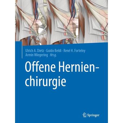 Offene Hernienchirurgie, Gebundene Ausgabe von , Springer Berlin, 978-3-662-61347-4