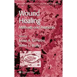 Wound Healing, Fachbücher von Luisa A. DiPietro, Aime L. Burns