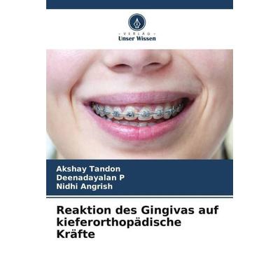 Reaktion des Gingivas auf kieferorthopädische Kräfte, Taschenbuch von Akshay Tandon,Deenadayalan P.,Nidhi Angrish, Verlag Unser Wissen,