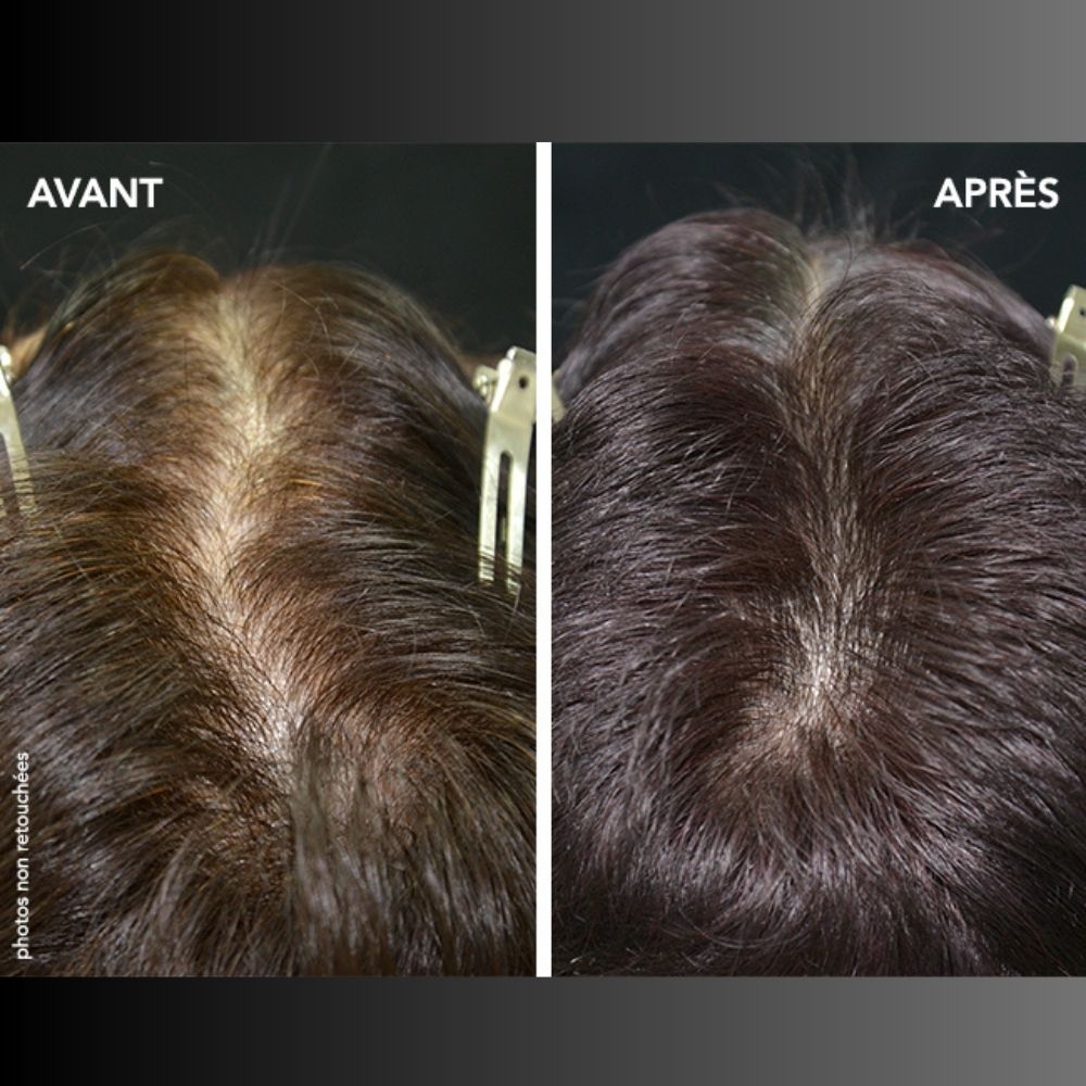 Phyto Paris cyane Complemento alimenticio Caída progresiva y severa del cabello 84&nbsp;caps.