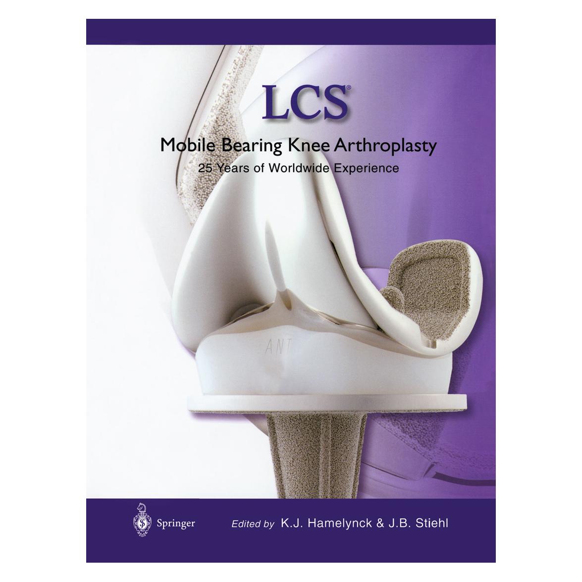 Springer LCS Mobile Bearing Knee Arthroplasty (Englisch, Softcover, James B. Stiehl, Karel J. Hamelynck) (55561029)