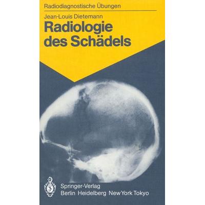 Radiologie des Schädels, Taschenbuch von J.-L. Dietemann, Springer Berlin, 978-3-540-13759-7