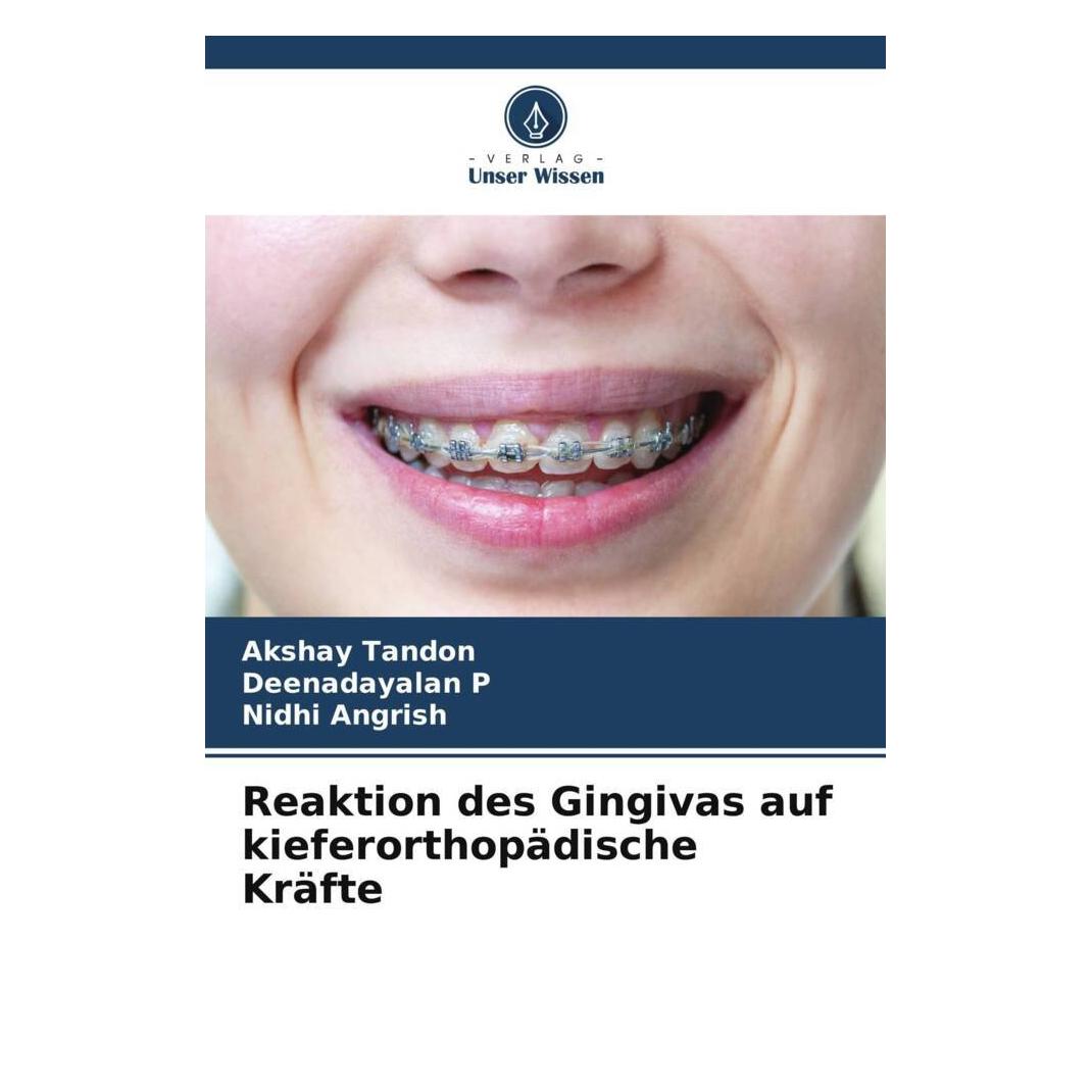 Unser Wissen Reaktion des Gingivas auf kieferorthopädische Kräfte (56893237)
