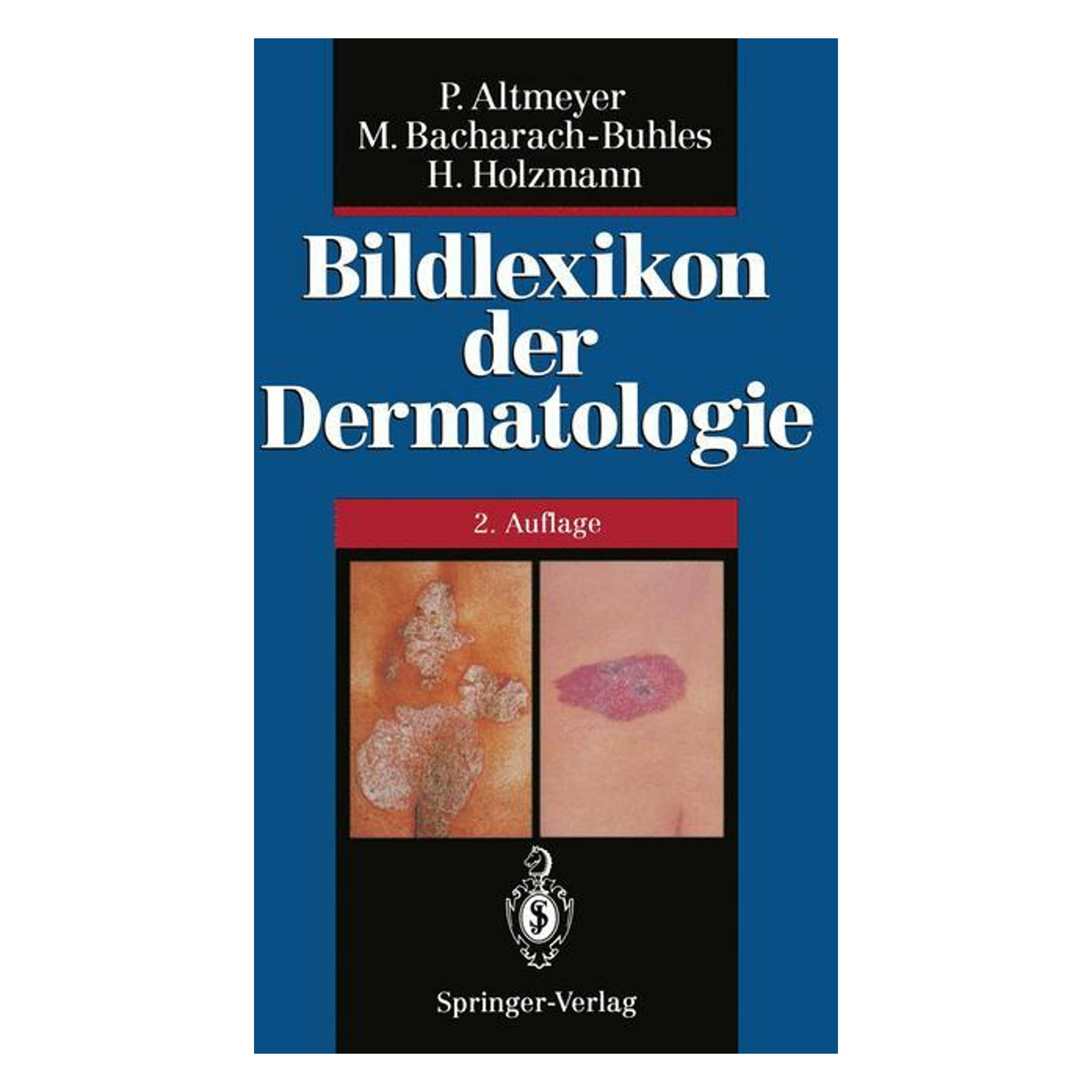 Springer Bildlexikon der Dermatologie (Deutsch, Softcover, Hans Holzmann, Martina Bacharach-Buhles, Peter Altmeyer) (7166069)
