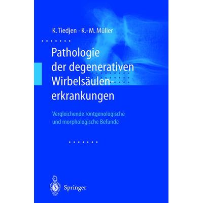 Pathologie der degenerativen Wirbelsäulenerkrankungen, Taschenbuch von Kay Tiedjen,Klaus-Michael Müller, Springer Berlin, 978-3-540-67774-1