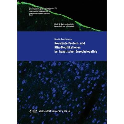 Kovalente Protein- und RNA-Modifikationen bei hepatischer Enzephalopathie, Taschenbuch von Natalia Qvartskhava, Düsseldorf university press dup,