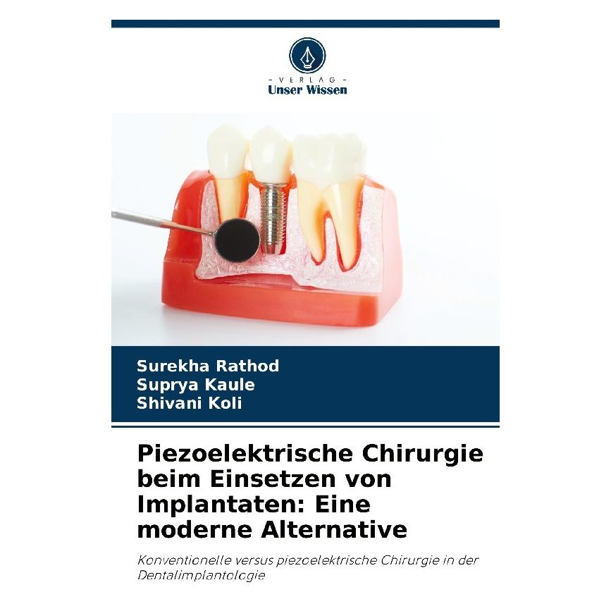 Bod Piezoelektrische Chirurgie beim Einsetzen von Implantaten: Eine moderne Alternat (Deutsch, Softcover, SHIVANI KOLI, Suprya Kaule, Surekha Rathod) (57220824)