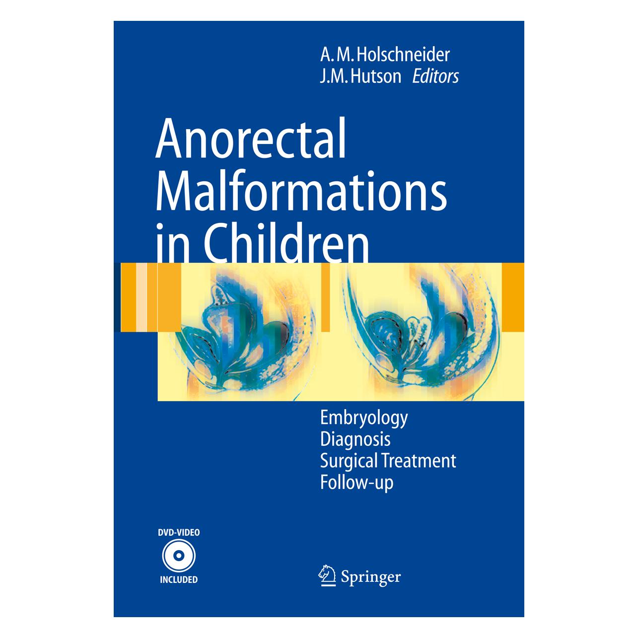Springer Anorectal Malformations in Children (Englisch, Softcover, Alexander Hutson, John M. Hutson, Matthias Holschneider) (55946872)