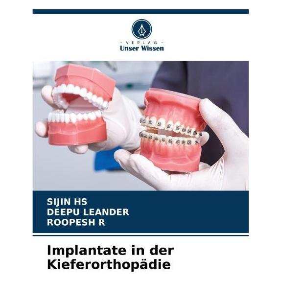 Bod Implantate in der Kieferorthopädie (Deutsch, Softcover, DEEPU LEANDER, ROOPESH R, SIJIN HS) (57220593)